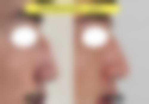 武威凉州黄羊镇中 心卫生院求美者反馈