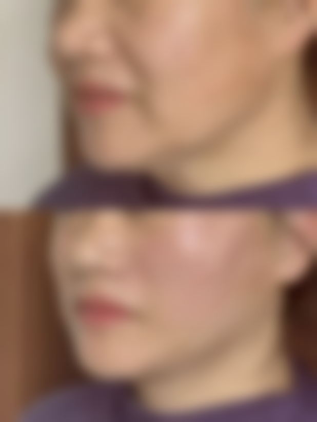 东莞中韩整形美容中 心求美者反馈