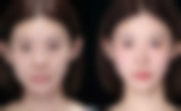 沈阳新面孔医疗美容诊所求美者反馈