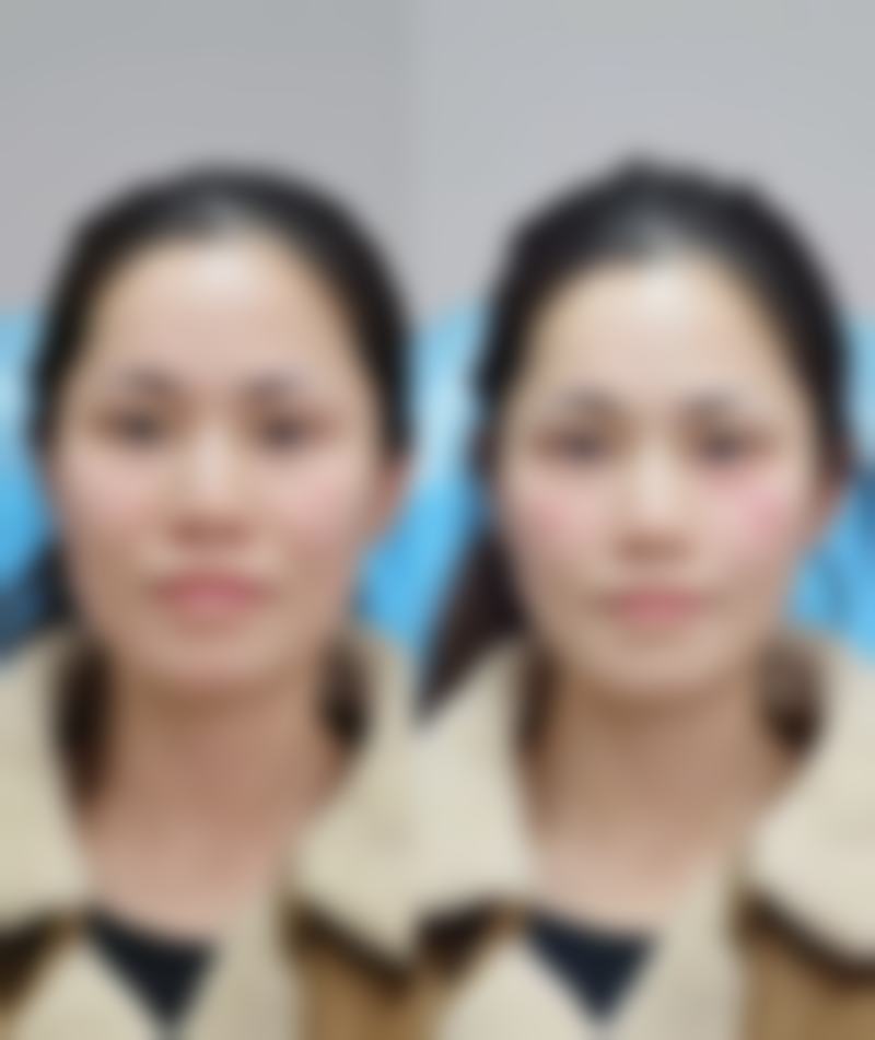 大连大学附属新华医院新华激光整形美容中 心简介概述