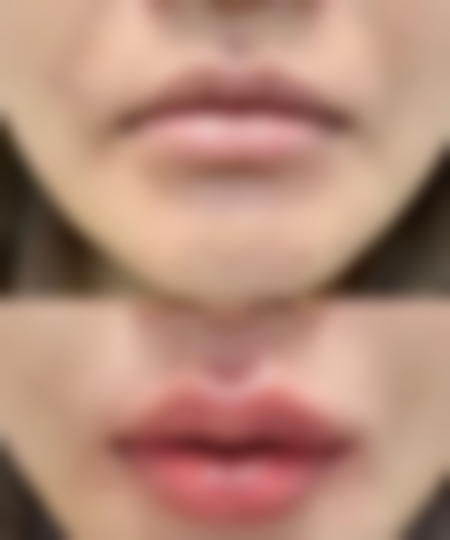 郑州瑞莱美医疗美容来院路线