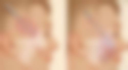 郑州市德尔美客凤凰医疗美容医院求美者反馈