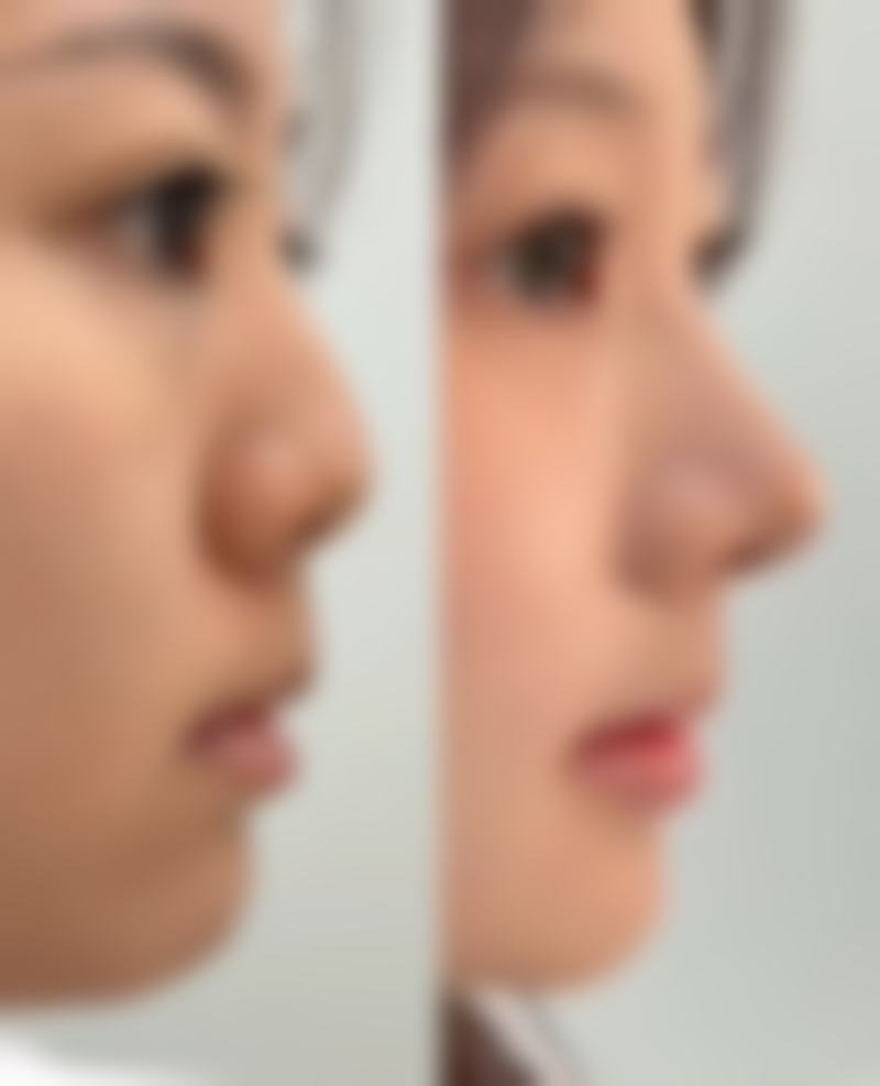 韩国DrBe整形外科皮肤科医院价格收费