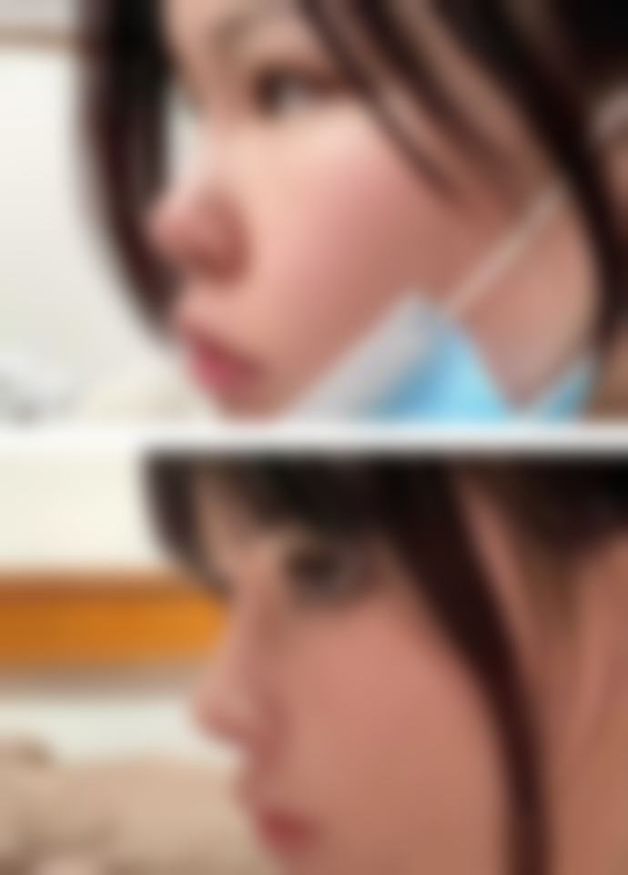 咸阳美好齿科诊所求美者反馈