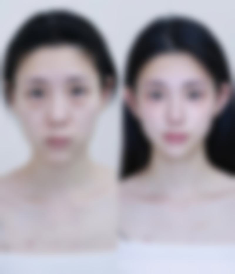 郑州市德尔美客凤凰医疗美容医院来院路线