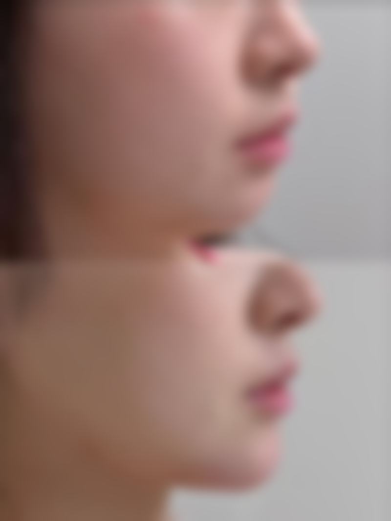 安庆星之地医疗美容门诊部求美者反馈