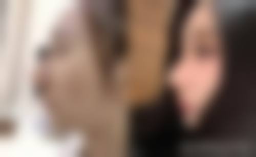 深圳甄颜医疗美容门诊部价格收费