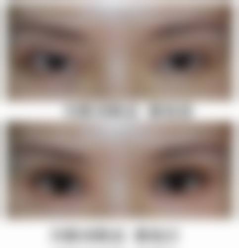 郑州美贝整形医院价格收费