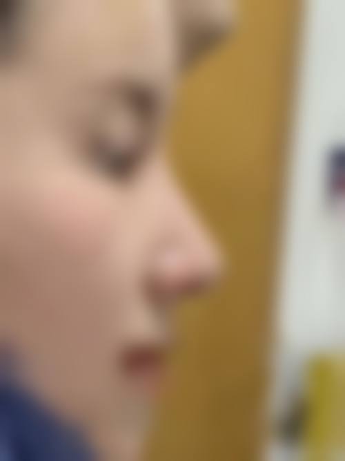 韩国姿色zises整形外科求美者反馈