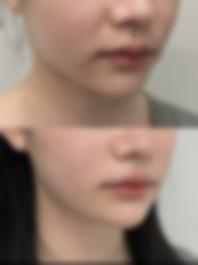 宝鸡渲梦氢氧整形医院来院路线