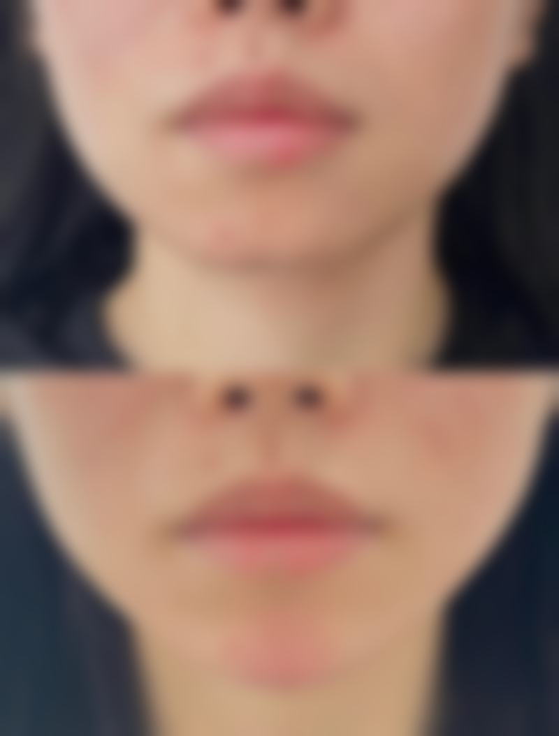 宝鸡渲梦氢氧整形医院求美者反馈