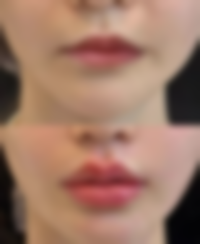 宝鸡渲梦氢氧整形医院价格收费