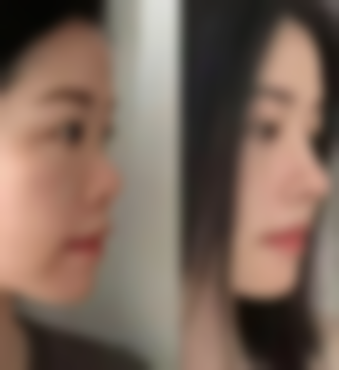 株洲雅美医疗美容门诊部求美者反馈