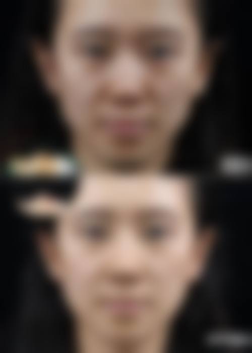 宋文正医生的专精整形项目一览