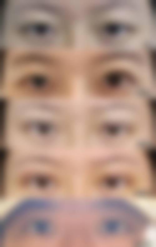 江油茗汇整形美容医院价格收费