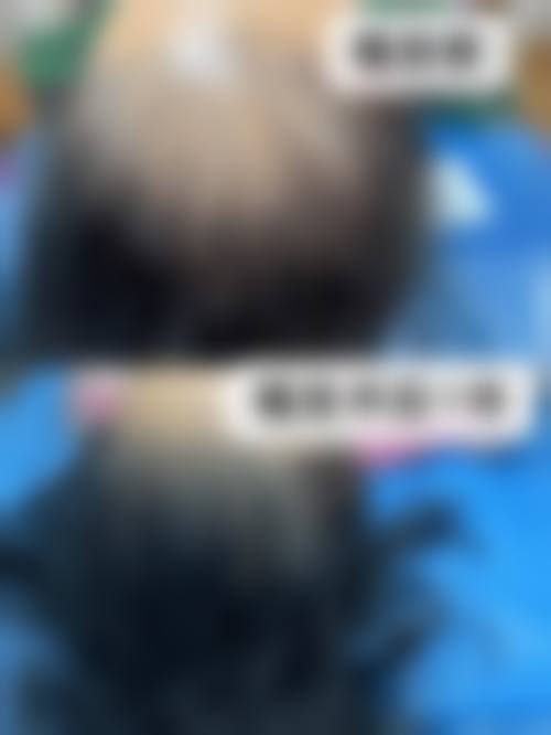 朴東满医师的个性化医美服务特色