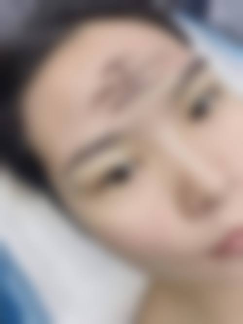 赖东兰医生依托的国内外标准医美保护