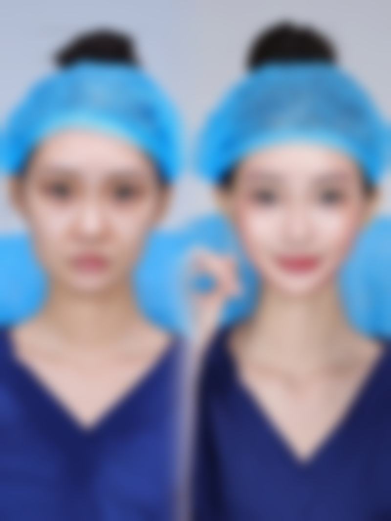 爱我整形外科求美者反馈