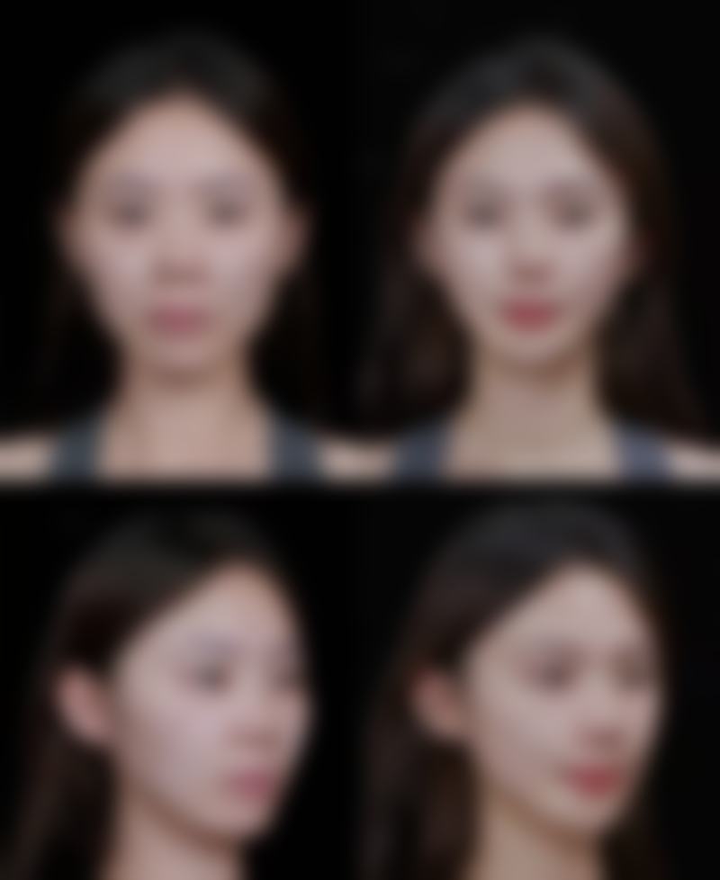 依托宿州京美标准化手术室的安心医美保护