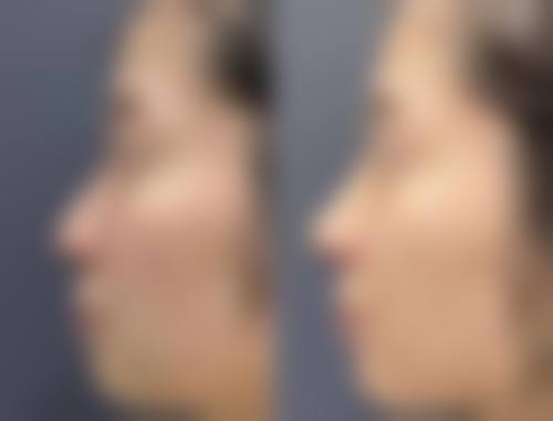 透明化收费:张云侠医生坐诊项目的参考价格