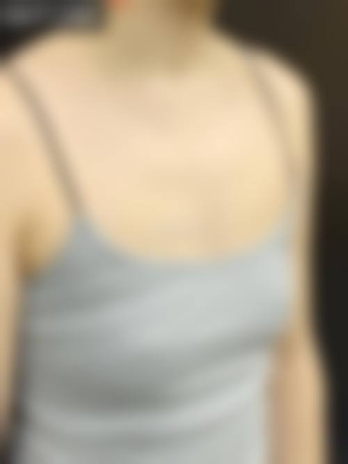 衡阳华美医疗美容门诊部价格收费