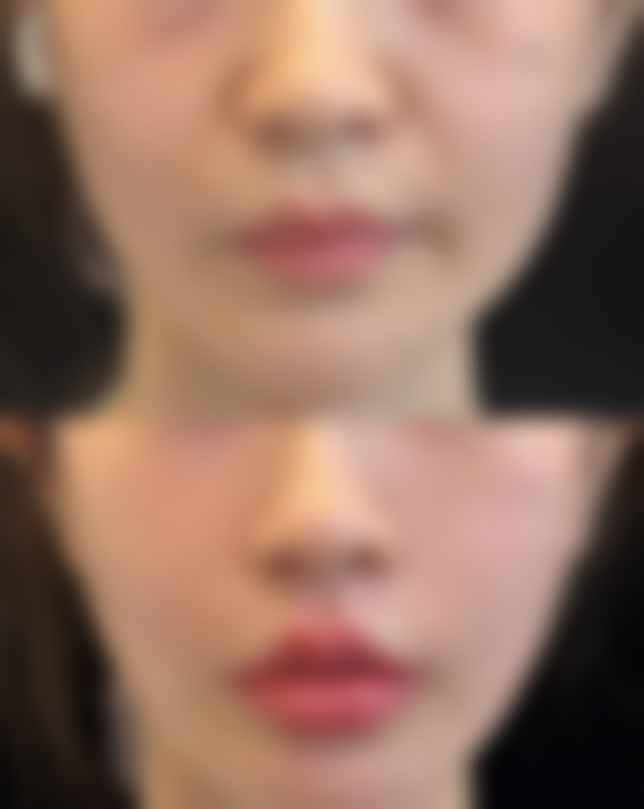 广州尚美善造整形门诊部价格收费