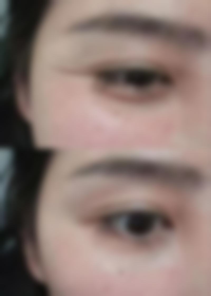 廊坊艾美整形医疗整形求美者反馈