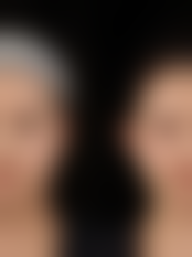 仙居福应星玥医疗美容诊所求美者反馈