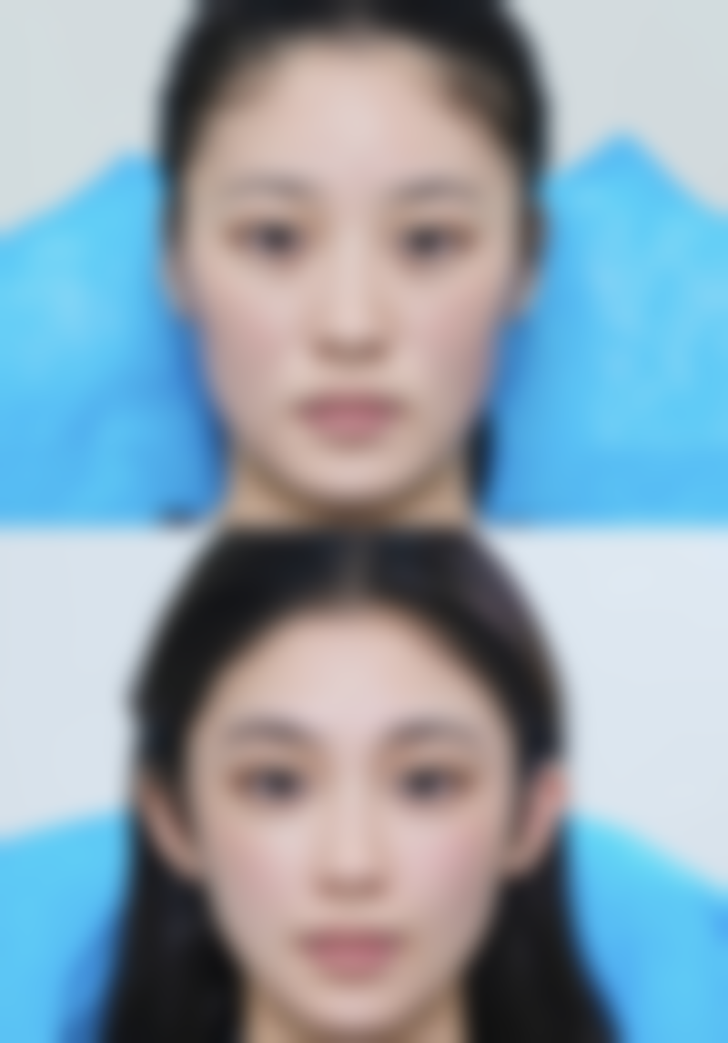 陕西天伦医院价格收费