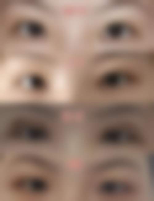 重庆善美整形医院求美者反馈