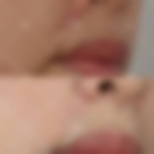 青岛金肤康皮肤病医院求美者反馈