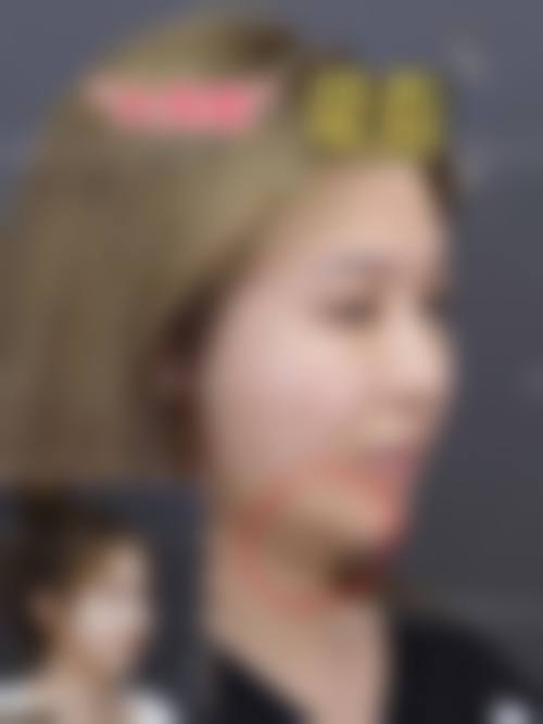 贵阳白云东美整形医院求美者反馈