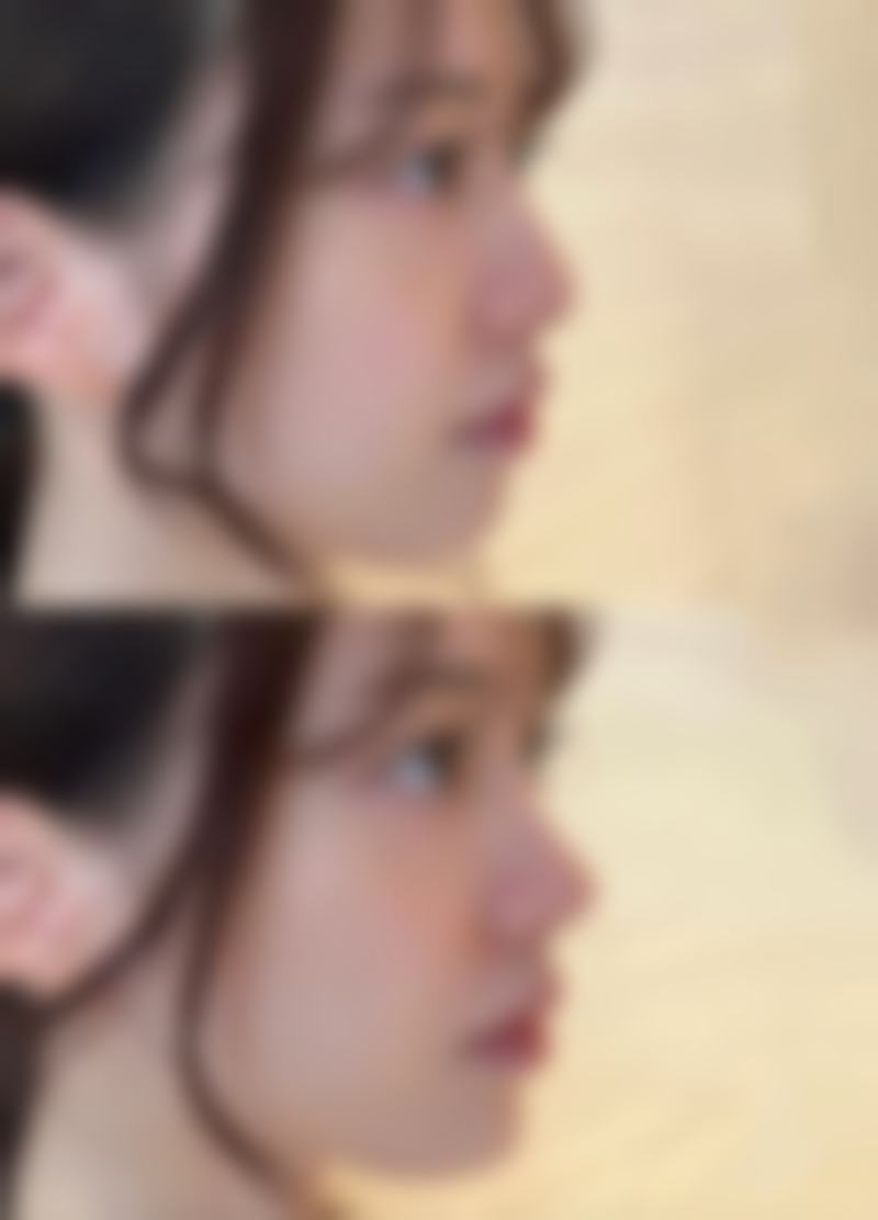 四川泸州医美花都整形美容医院求美者反馈