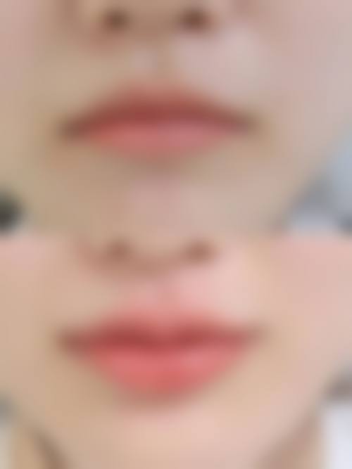 哈尔滨李翔整形医院来院路线