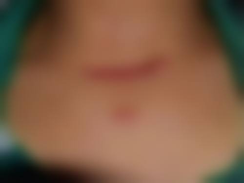 沈阳伊容疤痕医疗美容诊所简介概述