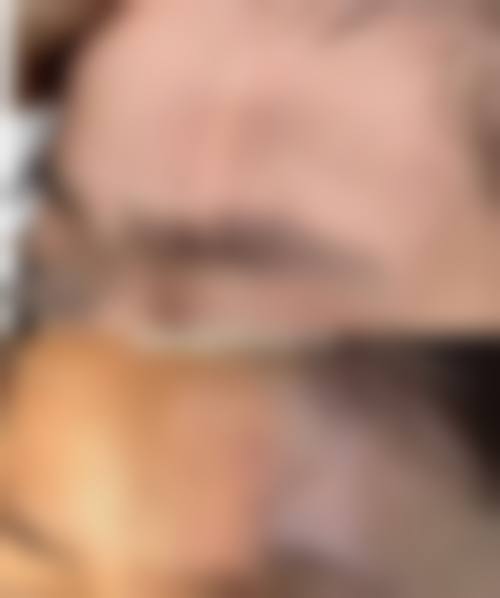 沈阳伊容疤痕医疗美容诊所求美者反馈