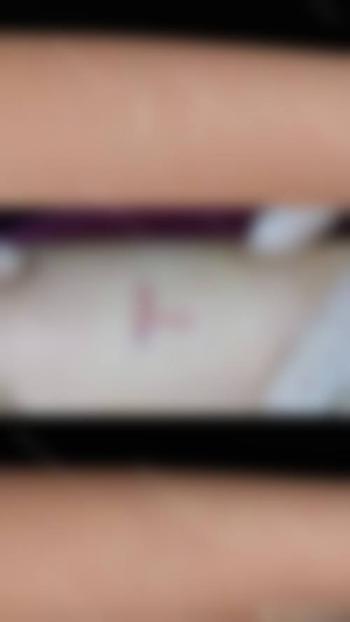 沈阳伊容疤痕医疗美容诊所来院路线