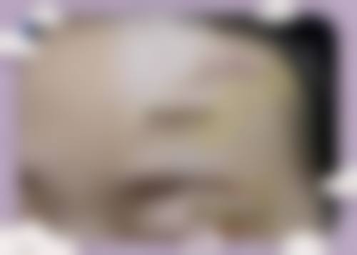 沈阳伊容疤痕医疗美容诊所价格收费