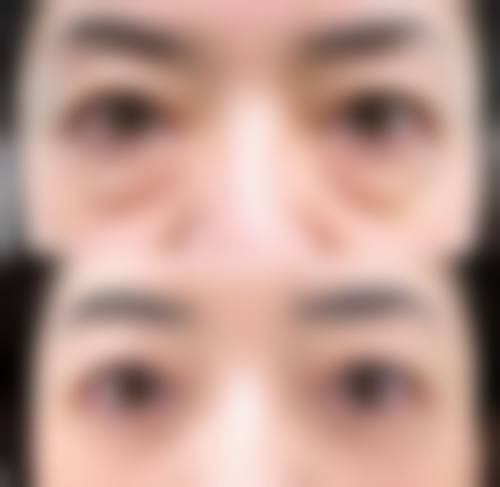 长春韵美医疗美容门诊部求美者反馈