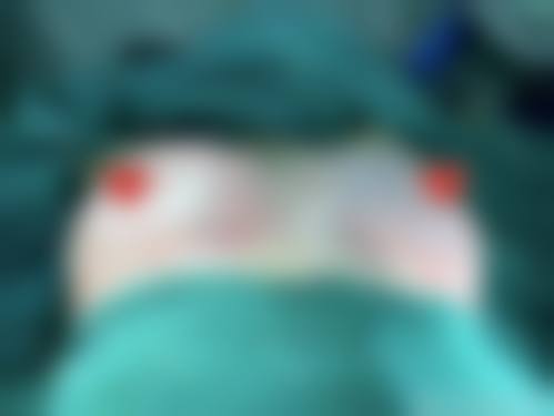 昆明悦玲珑医学美容价格收费