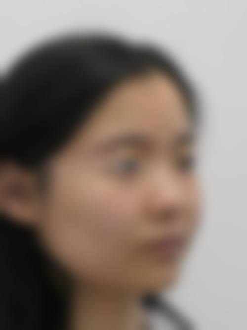 合肥市瑶海区第二门诊部求美者反馈
