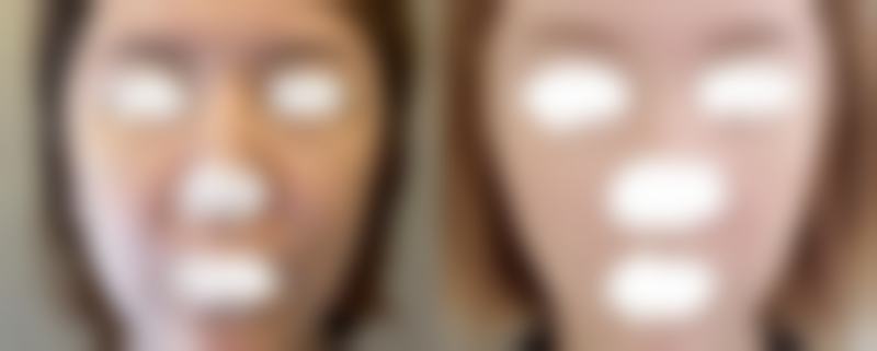 南京缪斯致美医疗美容医院求美者反馈