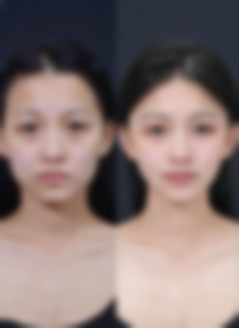 遵义播州语卿整形医院求美者反馈