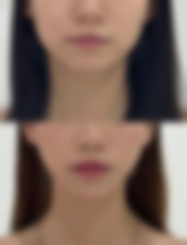 昆明悦玲珑医学美容特色项目及技术优势