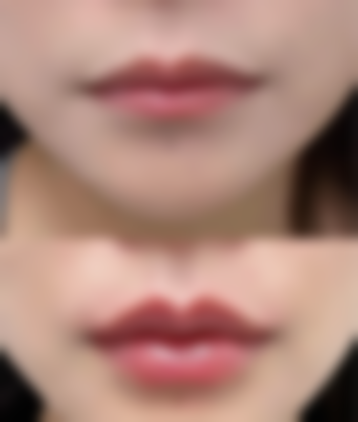 昆明悦玲珑医学美容来院路线