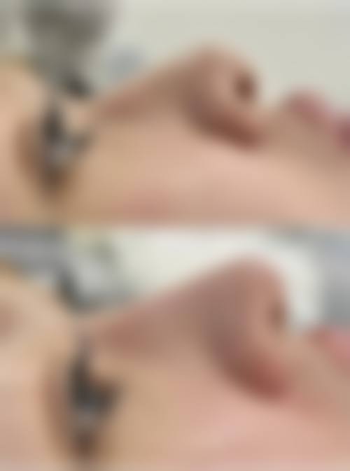 南京新秀私密医疗美容来院路线