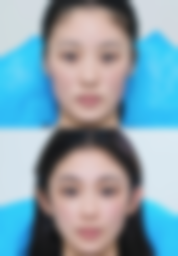 柳州茉莉医疗美容诊所价格收费