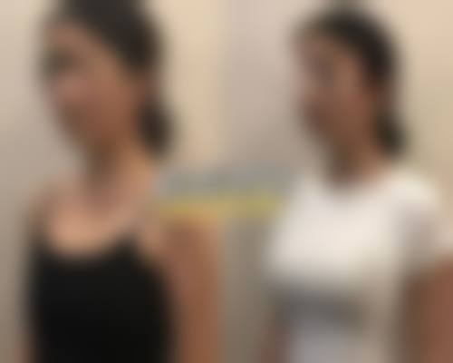 东胜百达丽整形医院求美者反馈