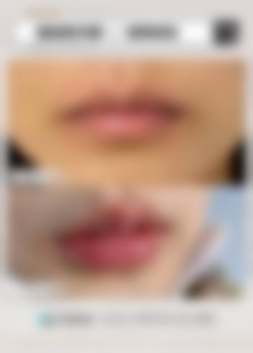 遵义泊美雅医疗美容医院价格收费