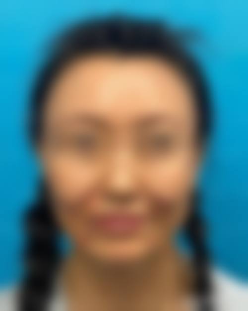 牡丹江蒂依夫人整形医院来院路线